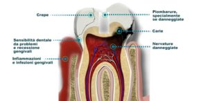 aloe-lovers-aloe-vera-per-il-mal-di-denti-dente