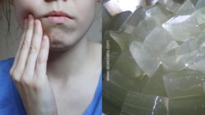 aloe-lovers-aloe-vera-per-il-mal-di-denti